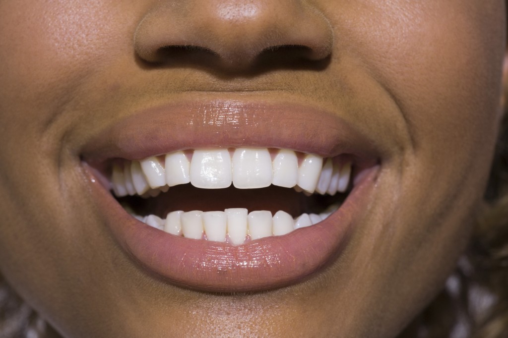 A closeup of a woman's smile