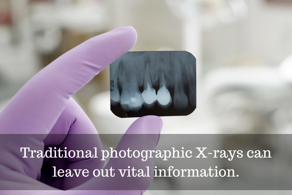 Traditional photographic x-rays can leave out vital information.