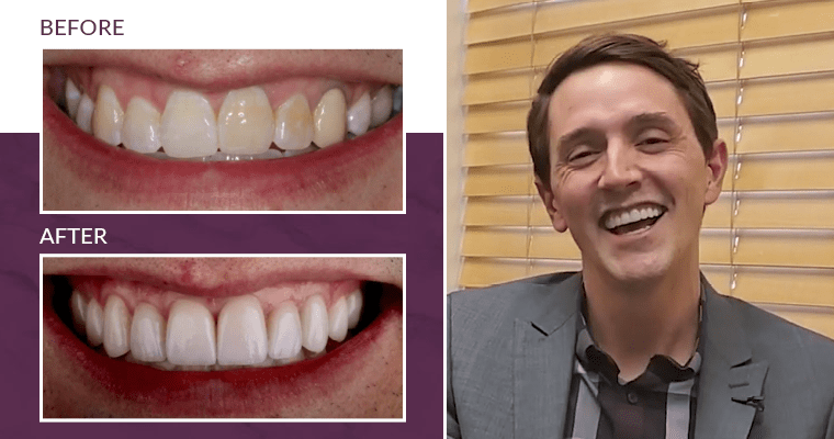 Matt's before-and-after smile makeover