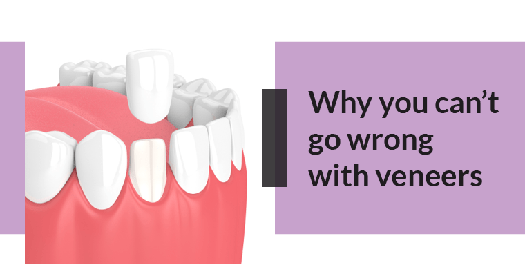 Stained teeth being fixed with perfectly white veneers.