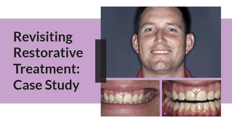 Case Study: Revisiting Restorative Treatment